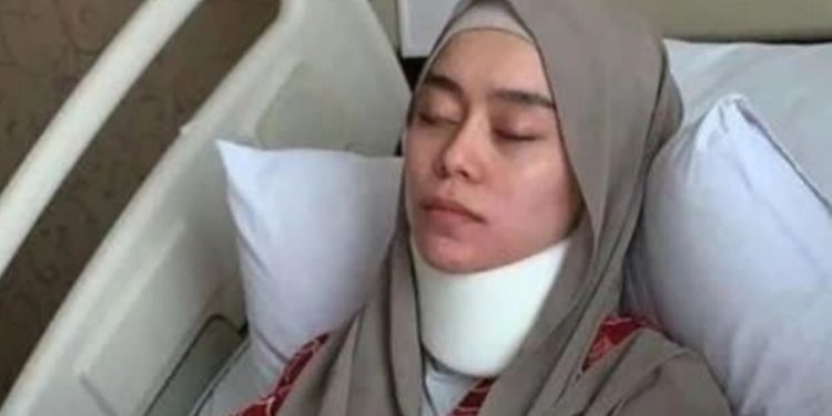 Kondisi Terbaru Lesti Kejora! Leher di Gips dan Pita Suaranya Terancam Rusak Akibat Cekikan Rizky Billar