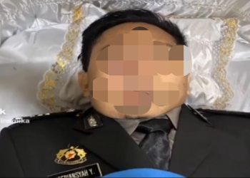 Ternyata Luka Bakar di Hidung Brigadir J Akibat Peluru Tembakan Ferdy Sambo dari Kepala Bagian Belakang