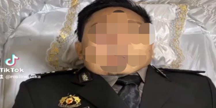 Ternyata Luka Bakar di Hidung Brigadir J Akibat Peluru Tembakan Ferdy Sambo dari Kepala Bagian Belakang