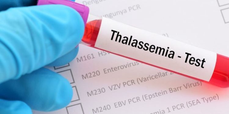 Periksa Penyakit Keturunan Sebelum Menikah Penting, Ini Alasannya