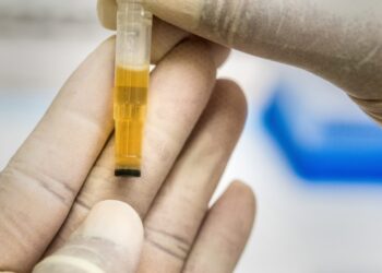 Semua Awak Kereta Api Daop 7 Madiun Dites Urine