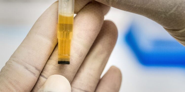 Semua Awak Kereta Api Daop 7 Madiun Dites Urine