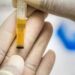 Semua Awak Kereta Api Daop 7 Madiun Dites Urine
