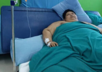 Innalillahi, Fajri Pasien Obesitas Asal Tangerang Tutup Usia di RSCM