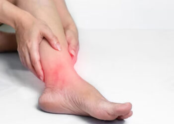 Penderita Asam Urat Diminta Hindari Lima Buah Ini!