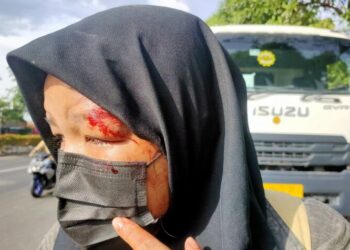 korban laka depan tangcity