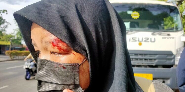 korban laka depan tangcity