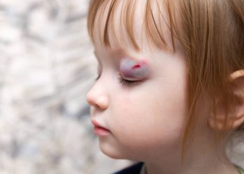 Polisi Periksa Saksi Terkait Kasus Kekerasan yang Menimpa Anak Perempuan 12 Tahun