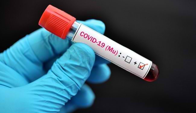 Tembus 25 Ribu Kasus, Singapura Dilanda Varian Baru Covid-19 FliRT