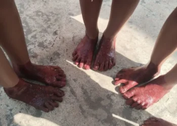 Tradisi Celup Kaki ke Darah Hewan Kurban di Palembang, Dipercaya Bisa Mengobati Penyakit Kulit
