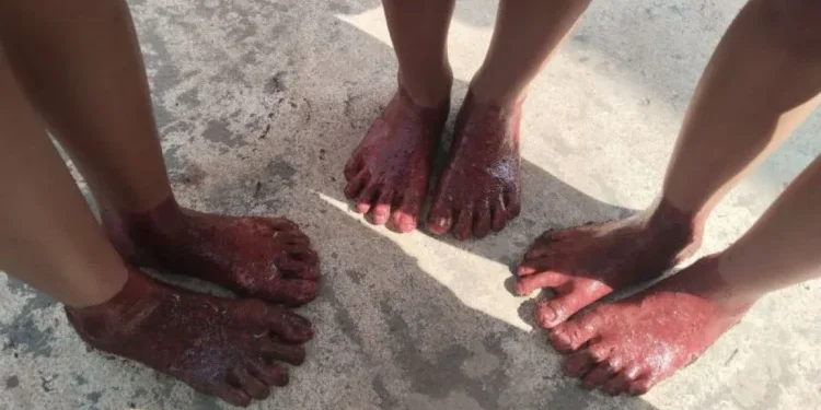 Tradisi Celup Kaki ke Darah Hewan Kurban di Palembang, Dipercaya Bisa Mengobati Penyakit Kulit
