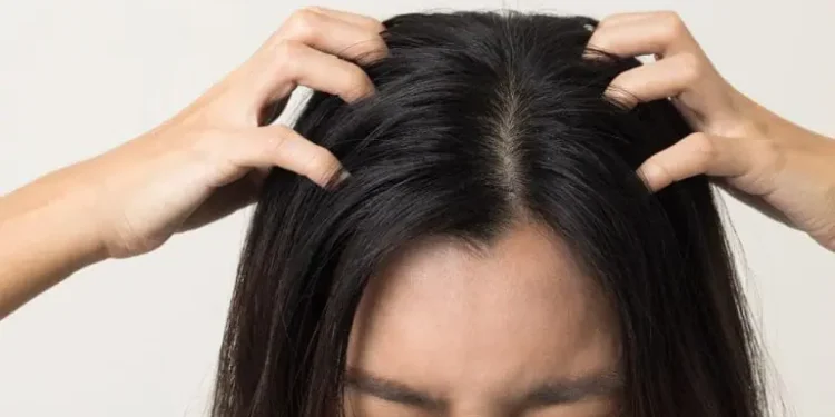 Kulit Kepala Gatal Belum Tentu Ketombe, Bisa Jadi Karena Penyakit Ini