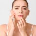 Dikira Jerawat Biasa Ternyata Fungal Acne, Apa Pemicu dan Perbedaannya?