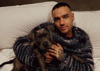Berdasar Hasil Autopsi Liam Payne Meninggal Akibat Polytrauma, Apakah Itu?