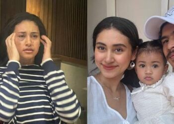 Viral, Selebgram Ini Unggah Foto Babak Belur Diduga Korban KDRT