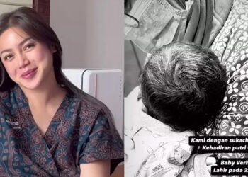 Habiskan Empat Kantong Darah Usai Melahirkan, Begini Kondisi Jessica Iskandar