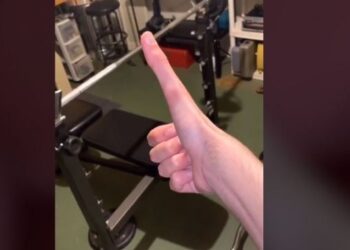Aneh Tapi Nyata, Pemilik Jempol Terpanjang di Dunia Asal Amerika Viral di Media Sosial