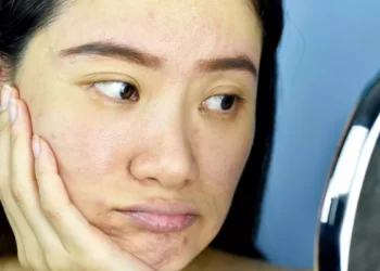 Kulit Rusak Akibat Pakai Pemutih? Jangan Sedih, Terapkan Cara Ini Agar Kinclong Lagi