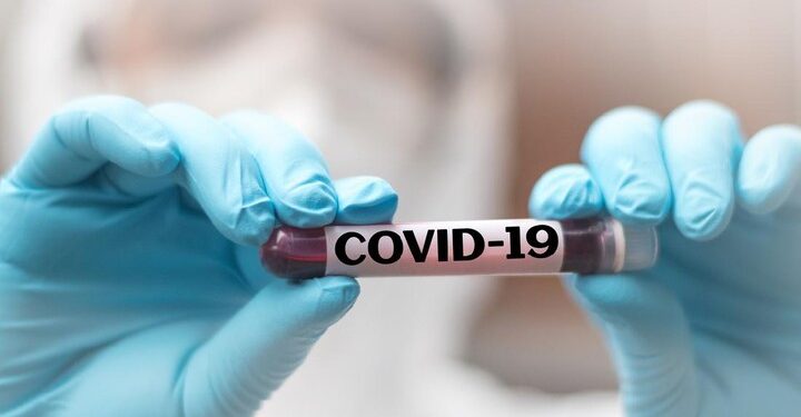 Kasus Covid-19 Melonjak Lagi? Jangan Panik, Ikuti Tips dan Saran Ahli Kesehatan Ini