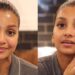 Viral Kulit Pisang jadi Pengganti Perawatan Botox, Mitos atau Fakta?