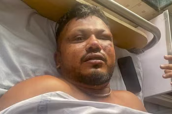 Detik-Detik Vishwas Kumar Ramesh Selamat dari Ledakan Pesawat Air India