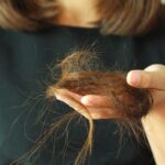 Stres Bisa Bikin Rambut Rontok, Ini Penjelasan dan Jenis-jenisnya