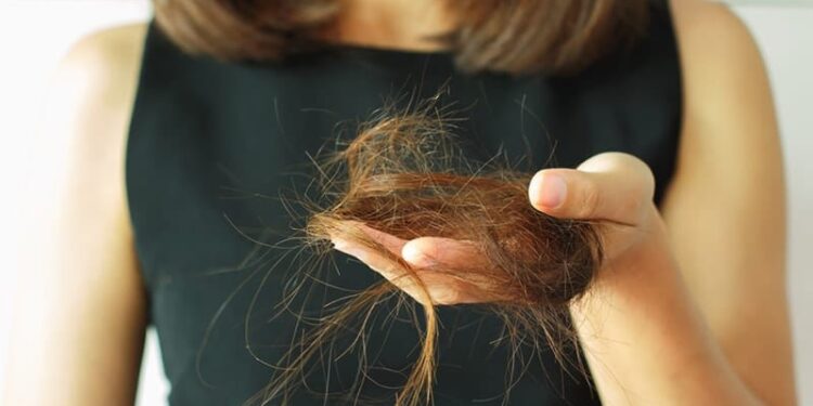 Stres Bisa Bikin Rambut Rontok, Ini Penjelasan dan Jenis-jenisnya
