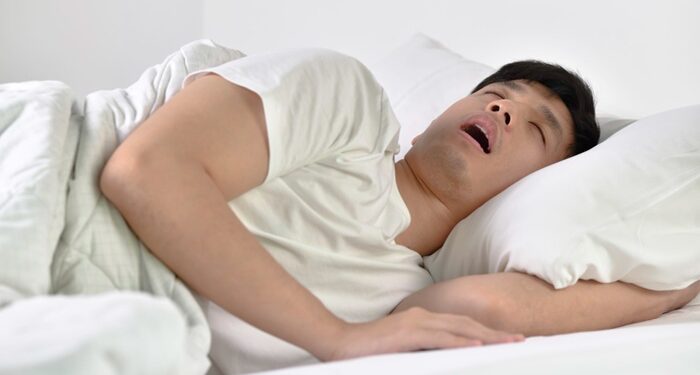 Kenali Gejala Sleep Apnea, dari Mendengkur hingga Lelah Kronis