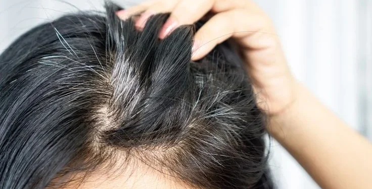 Studi: Rambut Beruban Jadi Sinyal Pertahanan Tubuh dari Kanker