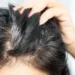 Studi: Rambut Beruban Jadi Sinyal Pertahanan Tubuh dari Kanker