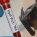 Dokter Ingatkan Bahaya Virus Nipah, Infeksi Langka yang Menyerang Otak Manusia