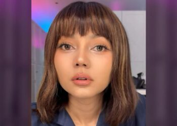 Rina Nose Blak-blakan Soal Operasi Plastik, Ini Alasan Sebenarnya