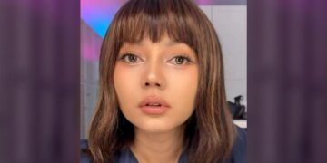 Rina Nose Blak-blakan Soal Operasi Plastik, Ini Alasan Sebenarnya