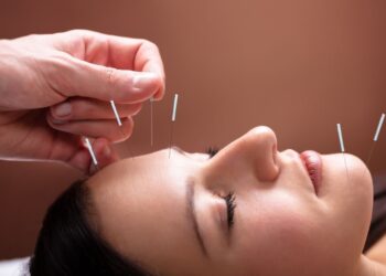 Akupunktur Wajah Kembali Tren, Disebut Jadi Alternatif Alami Pengganti Filler