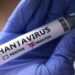 Sempat Positif Hantavirus, Pasien di Jawa Timur Berhasil Pulih Setelah Dirawat Intensif