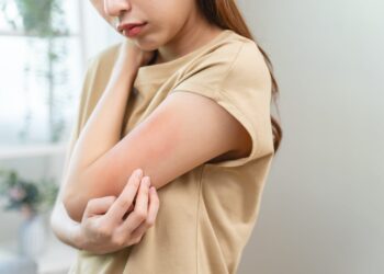 Jangan Sepelekan Kulit Gatal, Bisa Dipicu Defisiensi Vitamin dan Nutrisi