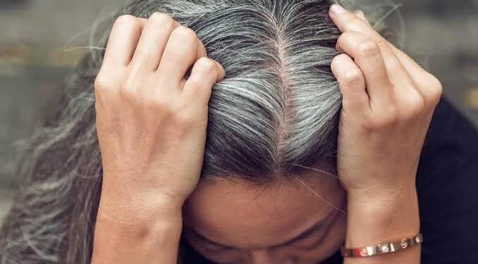 Uban Muncul di Usia Muda? Jangan Langsung Anggap Penuaan, Ini Penyebabnya
